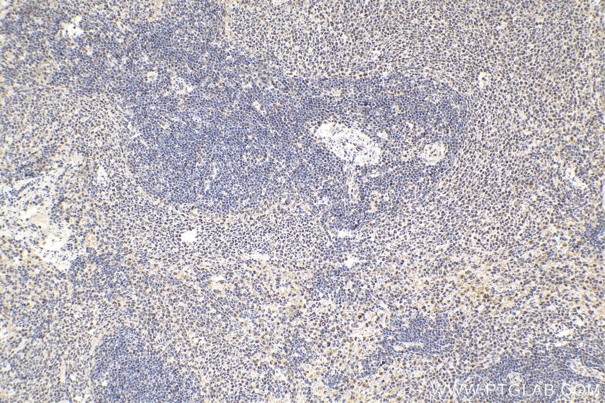 Immunohistochemistry (IHC) staining of rat spleen tissue using SMARCD2 Polyclonal antibody (11156-1-AP)