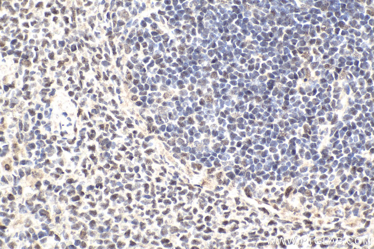 Immunohistochemistry (IHC) staining of rat spleen tissue using SMARCD2 Polyclonal antibody (11156-1-AP)