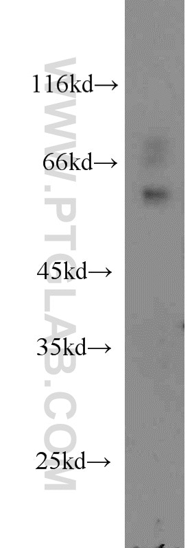 Western Blot (WB) analysis of RAW264.7 using SMARCD2 Polyclonal antibody (11156-1-AP)