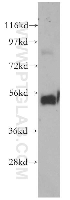 Western Blot (WB) analysis of mouse thymus tissue using SMARCD2 Polyclonal antibody (11156-1-AP)