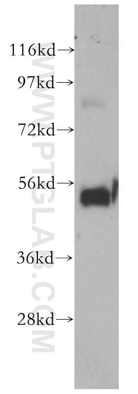 Western Blot (WB) analysis of mouse thymus tissue using SMARCD2 Polyclonal antibody (11156-1-AP)