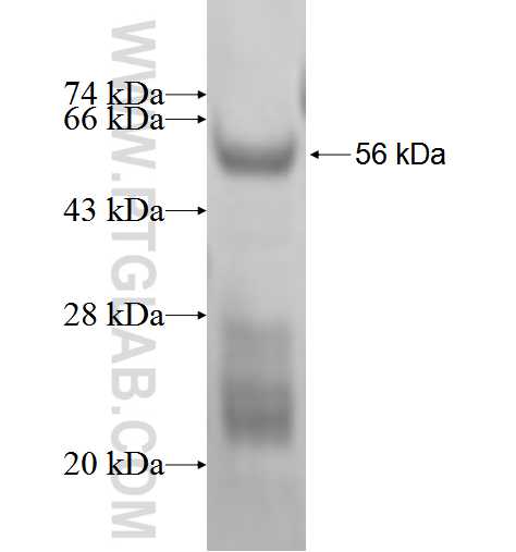 SMARCD2 fusion protein Ag1630 SDS-PAGE
