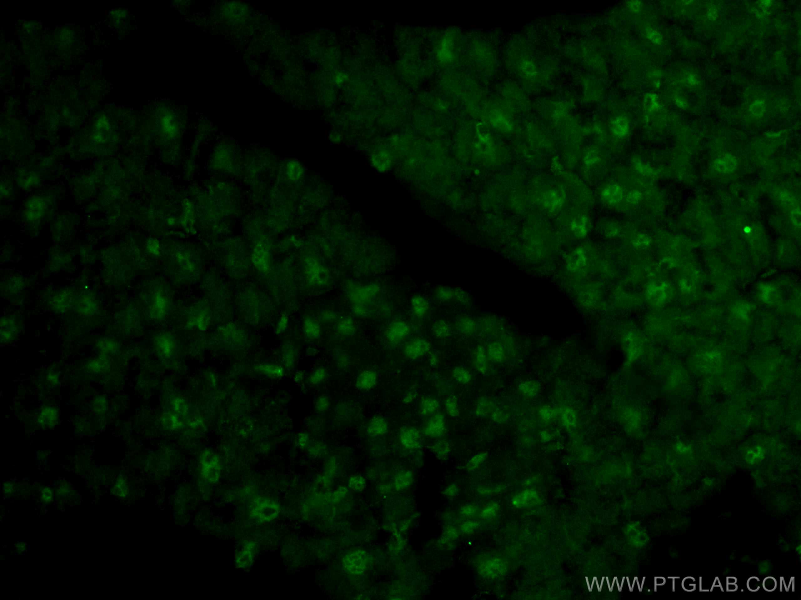 Immunofluorescence (IF) / fluorescent staining of mouse pancreas tissue using SMARCD3 Polyclonal antibody (12838-1-AP)