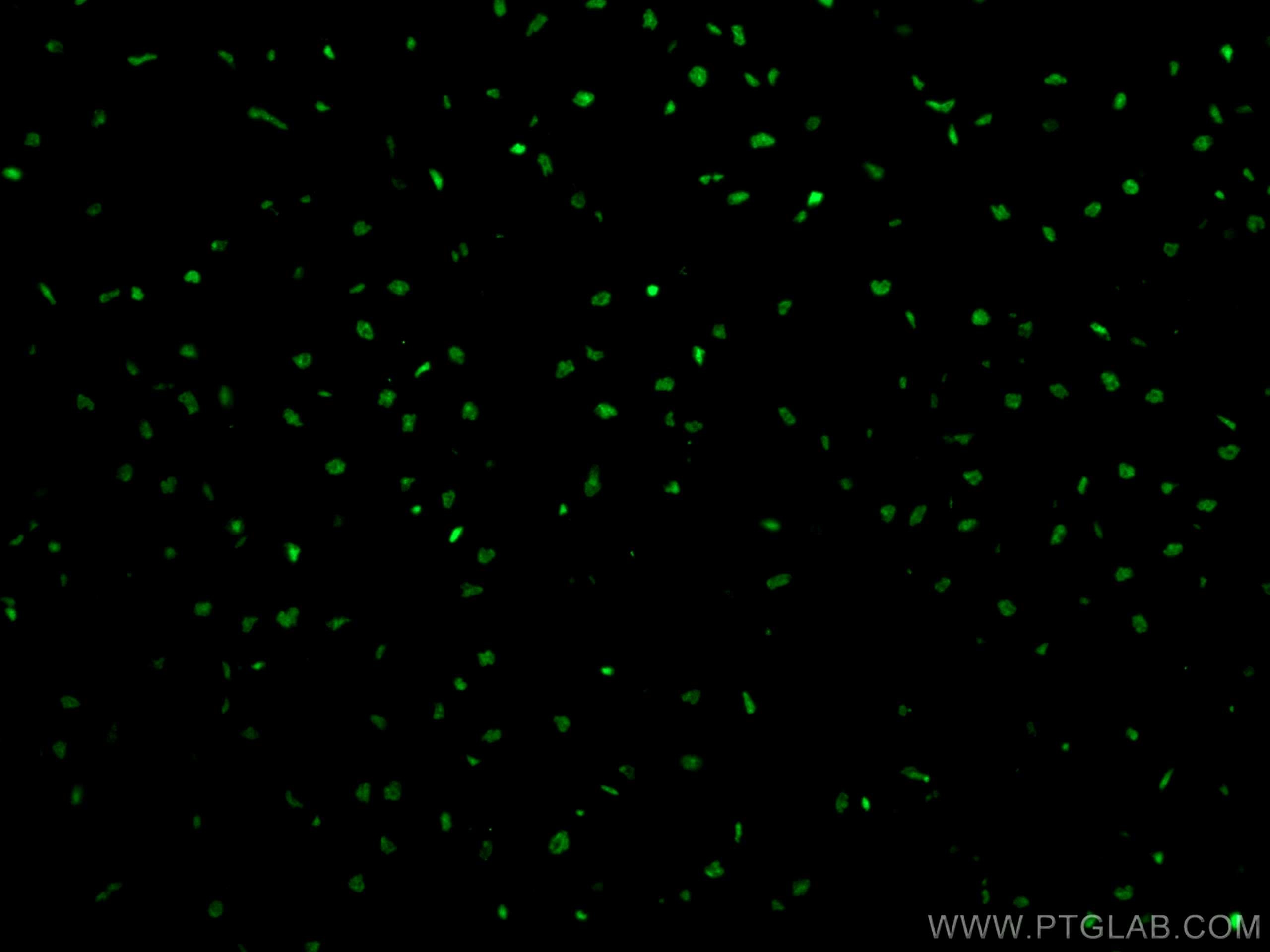 Immunofluorescence (IF) / fluorescent staining of human heart tissue using SMARCD3 Polyclonal antibody (12838-1-AP)