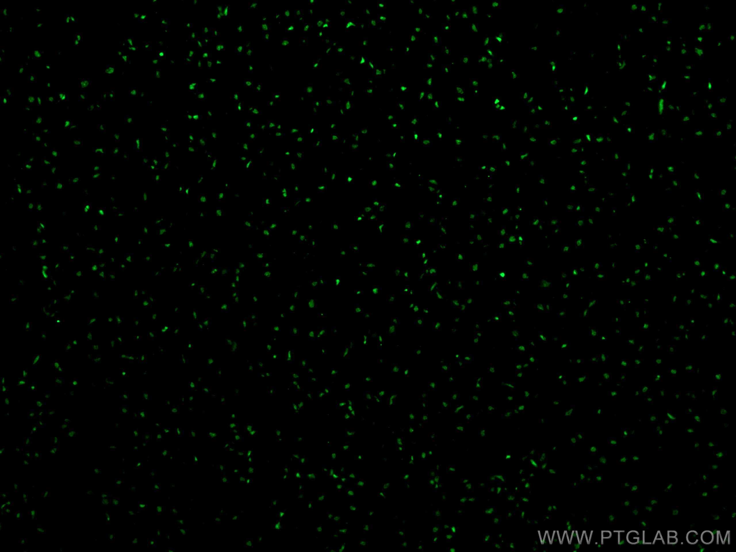 Immunofluorescence (IF) / fluorescent staining of human heart tissue using SMARCD3 Polyclonal antibody (12838-1-AP)