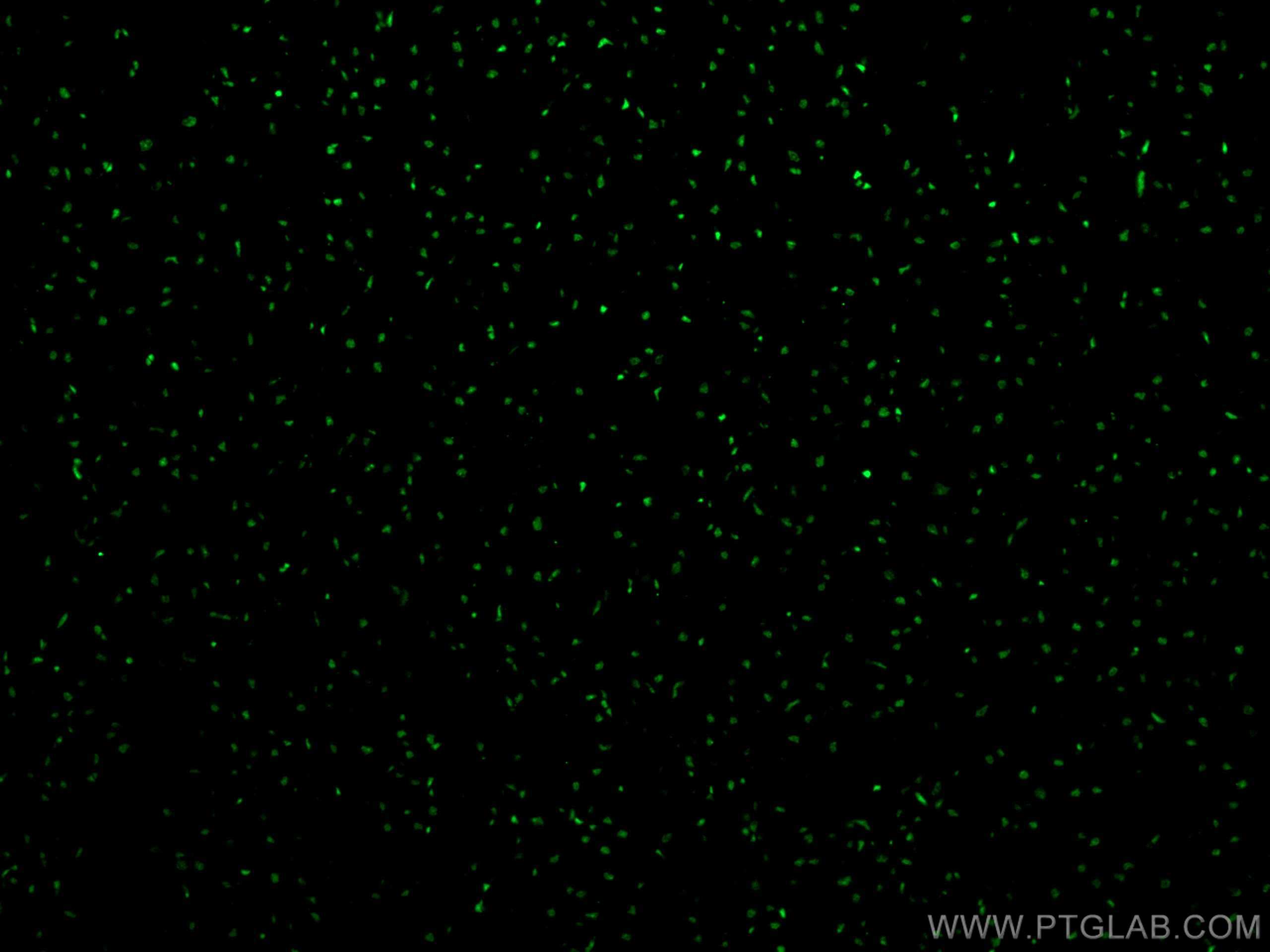 IF Staining of human heart using 12838-1-AP