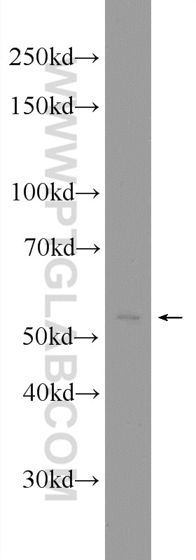 Western Blot (WB) analysis of HeLa cells using SMARCD3 Polyclonal antibody (12838-1-AP)