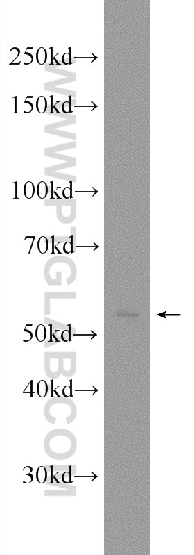 Western Blot (WB) analysis of HeLa cells using SMARCD3 Polyclonal antibody (12838-1-AP)