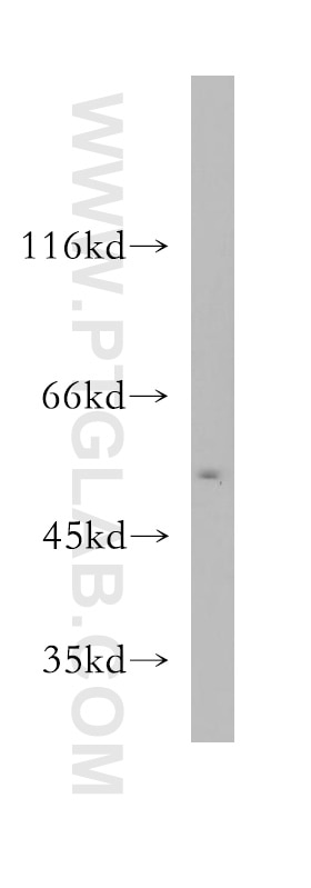 Western Blot (WB) analysis of BxPC-3 cells using SMARCD3 Polyclonal antibody (12838-1-AP)