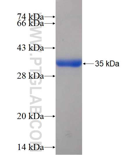 SMARCD3 fusion protein Ag3896 SDS-PAGE
