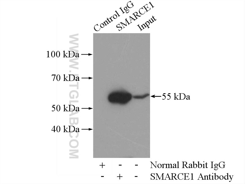 Immunoprecipitation (IP) experiment of HEK-293 cells using SMARCE1 Polyclonal antibody (10814-1-AP)