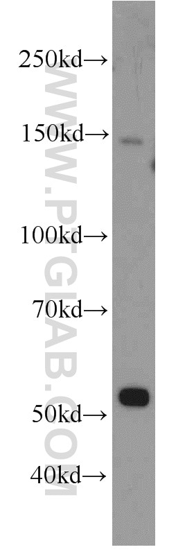 WB analysis of HeLa using 10814-1-AP