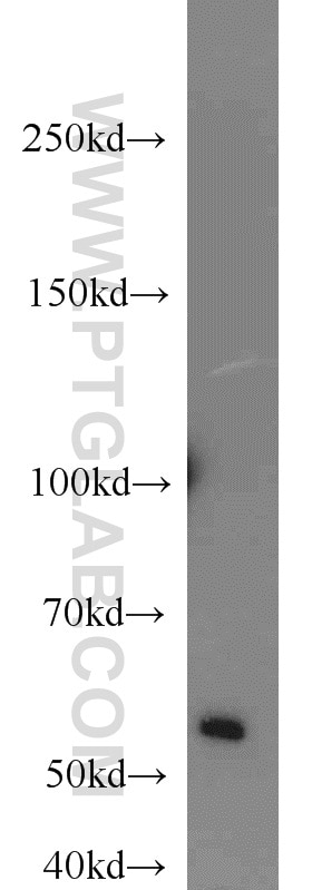 Western Blot (WB) analysis of Jurkat cells using SMARCE1 Polyclonal antibody (10814-1-AP)