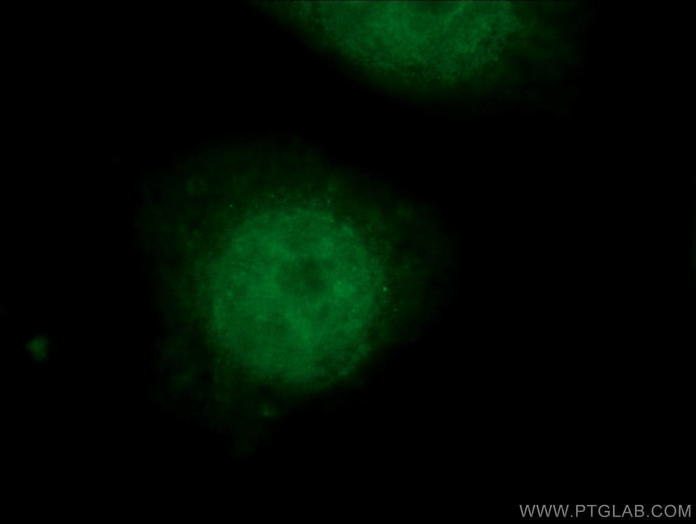 Immunofluorescence (IF) / fluorescent staining of HEK-293 cells using SMARCE1 Monoclonal antibody (66182-1-Ig)