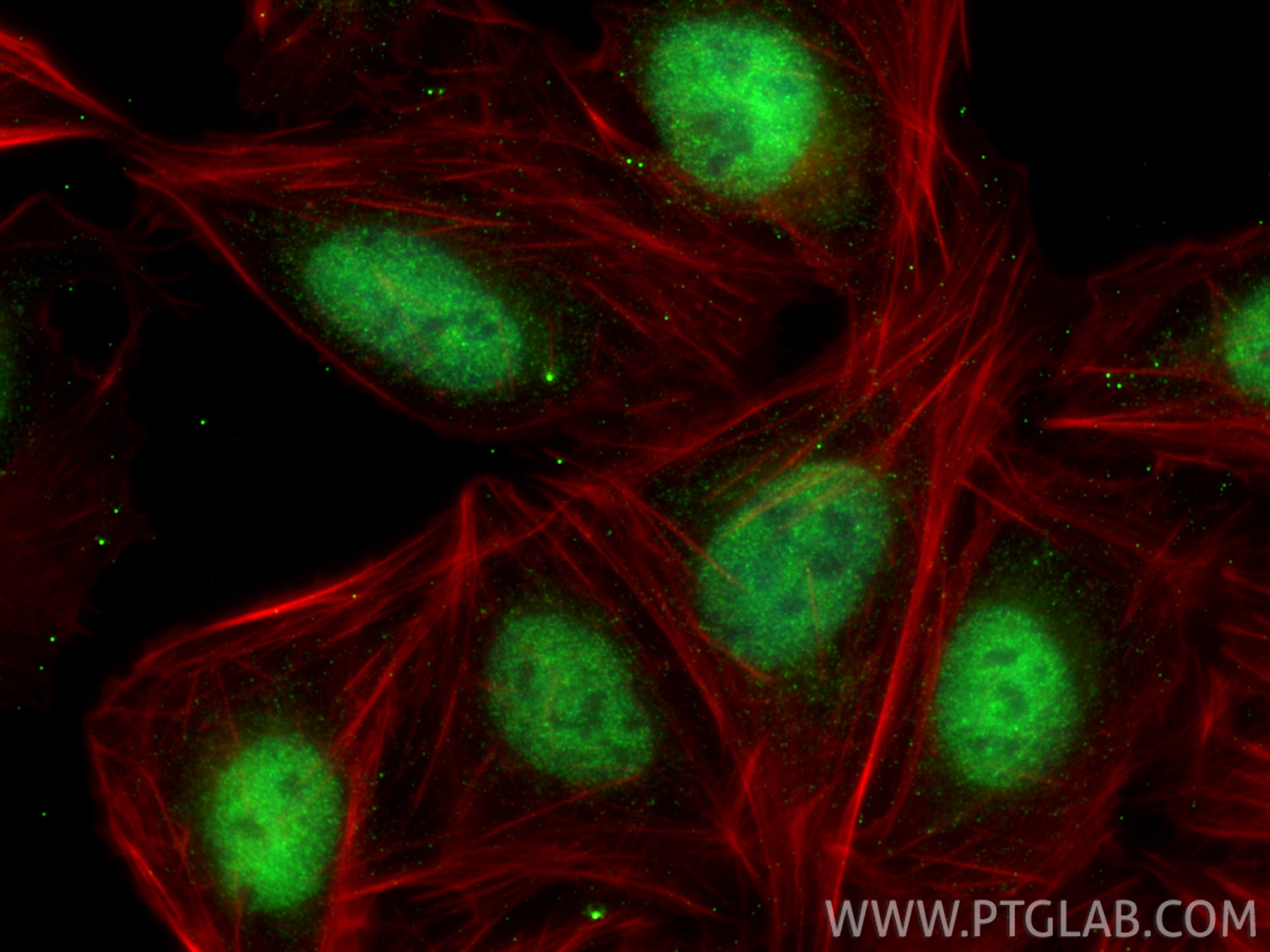 Immunofluorescence (IF) / fluorescent staining of U2OS cells using SMARCE1 Monoclonal antibody (66182-1-Ig)