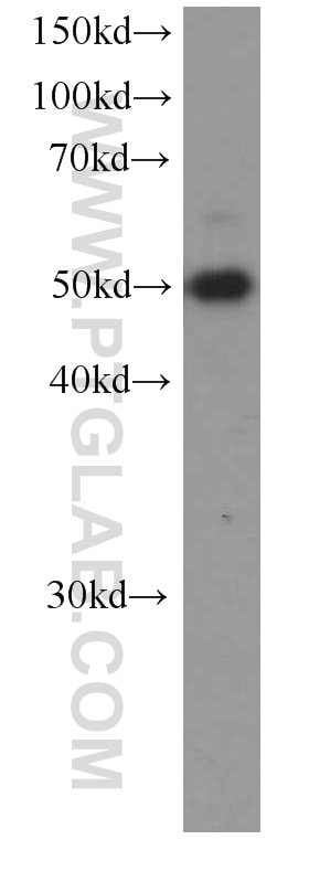 Western Blot (WB) analysis of Jurkat cells using SMARCE1 Monoclonal antibody (66182-1-Ig)