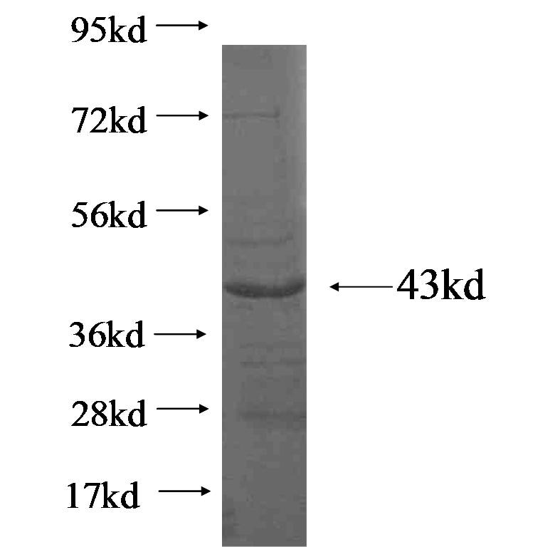 SMARCE1 fusion protein Ag19110 SDS-PAGE