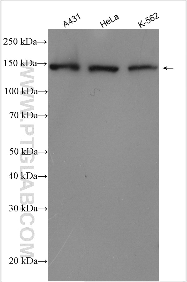 Western Blot (WB) analysis of various lysates using SMC1A Polyclonal antibody (21695-1-AP)
