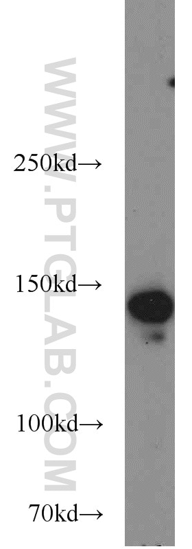 Western Blot (WB) analysis of HeLa cells using SMC1A Polyclonal antibody (21695-1-AP)