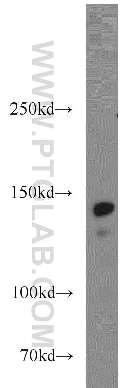 Western Blot (WB) analysis of K-562 cells using SMC1A Polyclonal antibody (21695-1-AP)