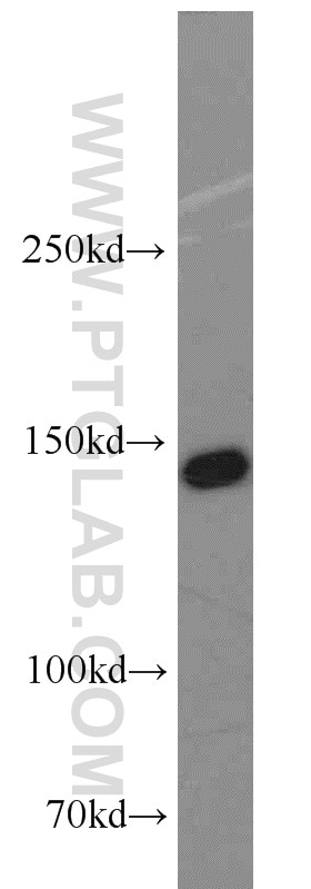 Western Blot (WB) analysis of A431 cells using SMC1A Polyclonal antibody (21695-1-AP)