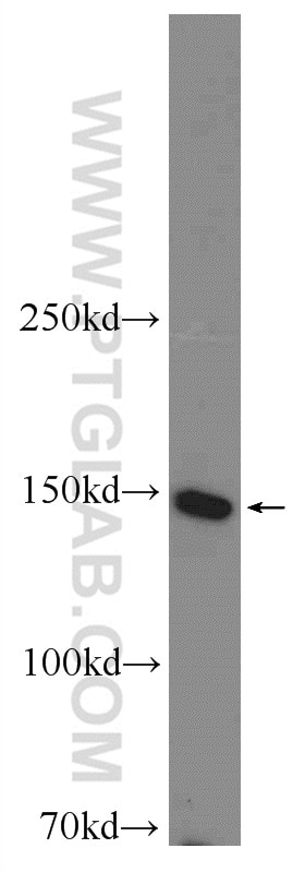 Western Blot (WB) analysis of NIH/3T3 cells using SMC1A Polyclonal antibody (21695-1-AP)