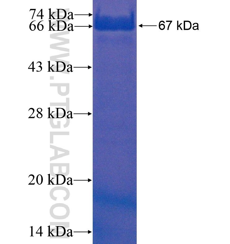 SMC1A fusion protein Ag16286 SDS-PAGE