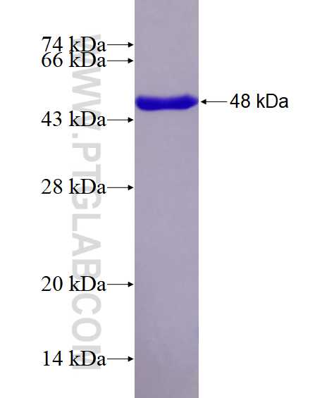 SMC1A fusion protein Ag17257 SDS-PAGE