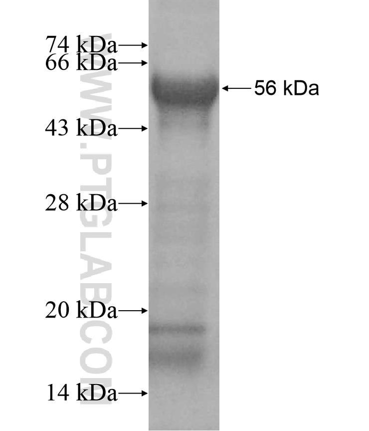 SMC1B fusion protein Ag17123 SDS-PAGE