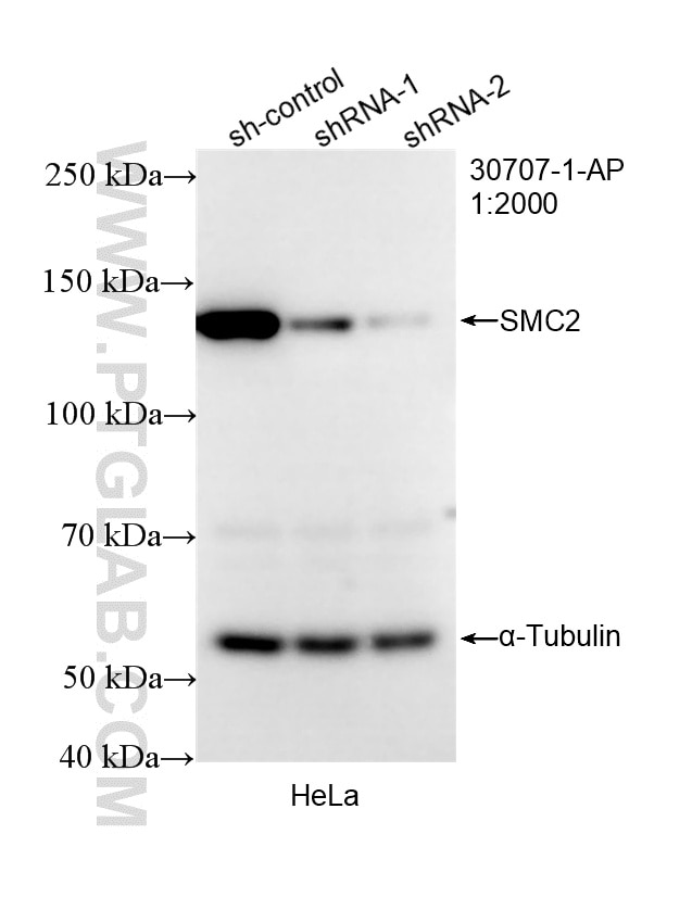 Western Blot (WB) analysis of HeLa cells using SMC2 Polyclonal antibody (30707-1-AP)