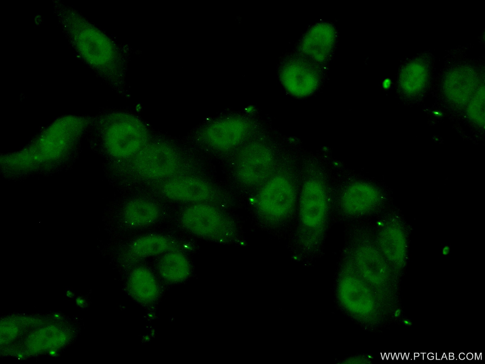 Immunofluorescence (IF) / fluorescent staining of HeLa cells using SMC3 Polyclonal antibody (14185-1-AP)