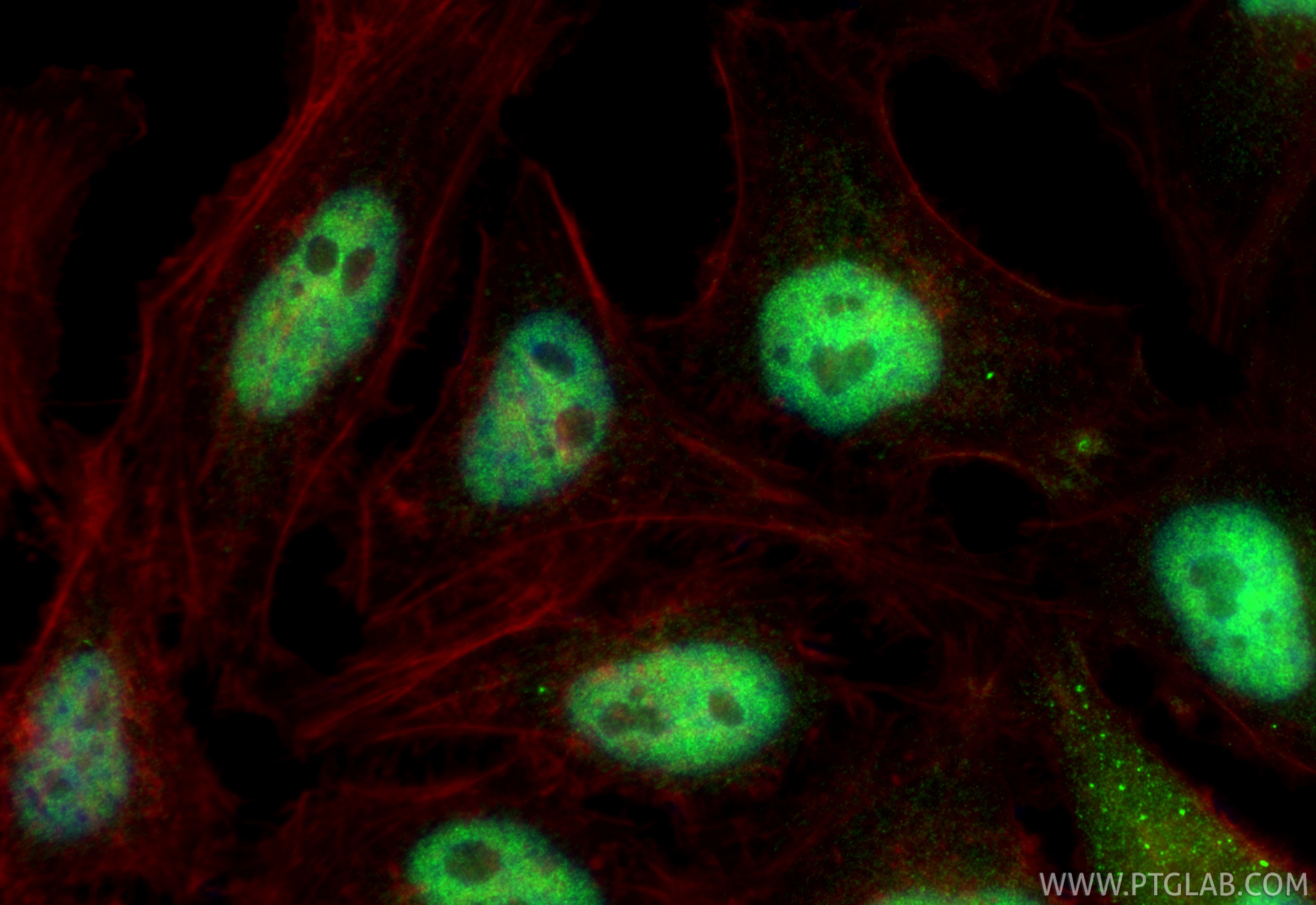 Immunofluorescence (IF) / fluorescent staining of HeLa cells using SMC3 Polyclonal antibody (14185-1-AP)