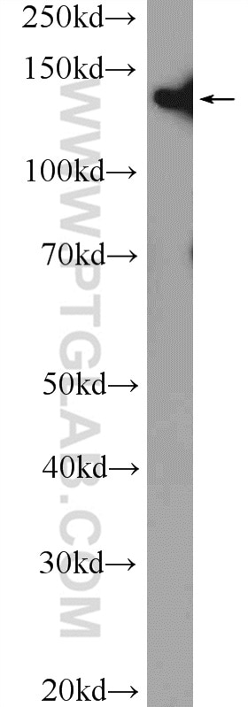 Western Blot (WB) analysis of Jurkat cells using SMC3 Polyclonal antibody (14185-1-AP)