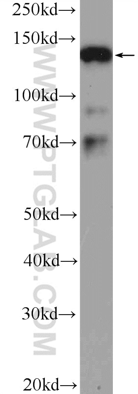 Western Blot (WB) analysis of Jurkat cells using SMC3 Polyclonal antibody (14185-1-PBS)