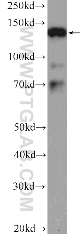 Western Blot (WB) analysis of Jurkat cells using SMC3 Polyclonal antibody (14185-1-PBS)