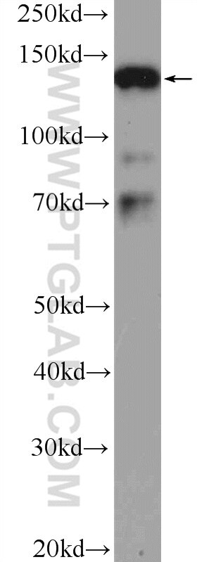 WB analysis of Jurkat using 14185-1-PBS