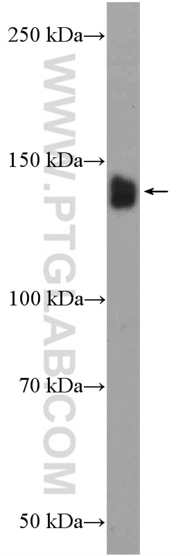 Western Blot (WB) analysis of mouse brain tissue using SMC3 Polyclonal antibody (14185-1-AP)