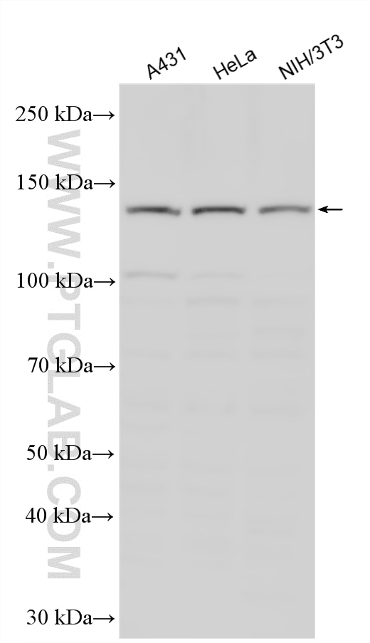 Western Blot (WB) analysis of various lysates using SMC3 Polyclonal antibody (14185-1-AP)