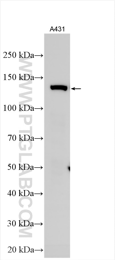 Western Blot (WB) analysis of various lysates using SMC3 Polyclonal antibody (14185-1-AP)