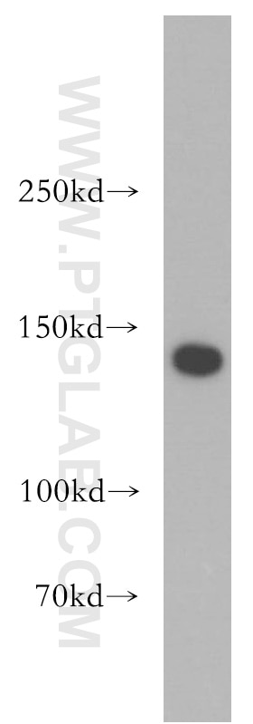 Western Blot (WB) analysis of HeLa cells using SMC3 Polyclonal antibody (14185-1-AP)