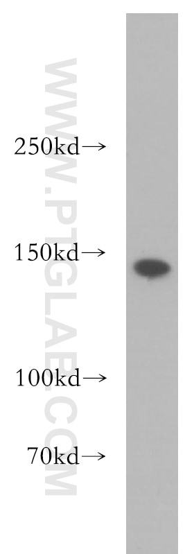 Western Blot (WB) analysis of Jurkat cells using SMC3 Polyclonal antibody (14185-1-AP)