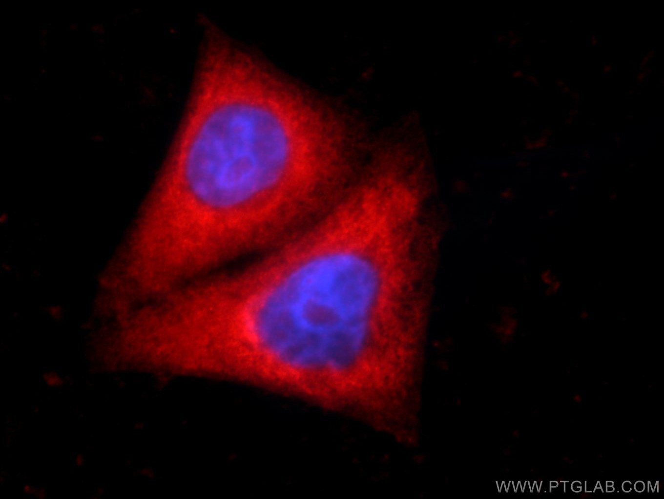 Immunofluorescence (IF) / fluorescent staining of HepG2 cells using SMC4 Polyclonal antibody (24758-1-AP)