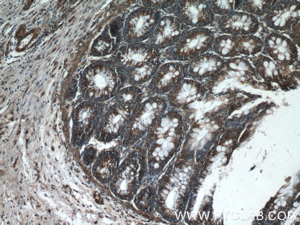 Immunohistochemistry (IHC) staining of human colon tissue using SMC4 Polyclonal antibody (24758-1-AP)