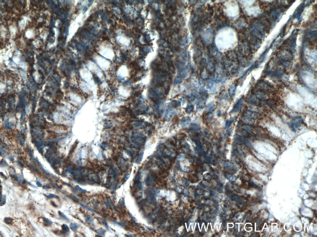 Immunohistochemistry (IHC) staining of human colon tissue using SMC4 Polyclonal antibody (24758-1-AP)