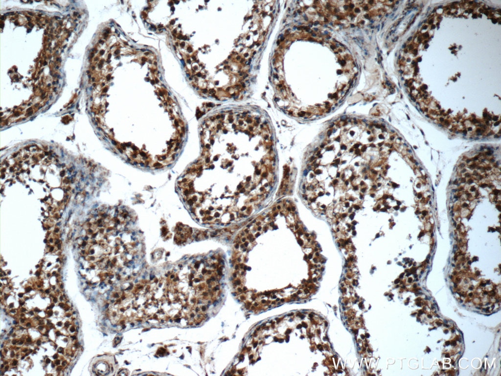 Immunohistochemistry (IHC) staining of human testis tissue using SMC4 Polyclonal antibody (24758-1-AP)
