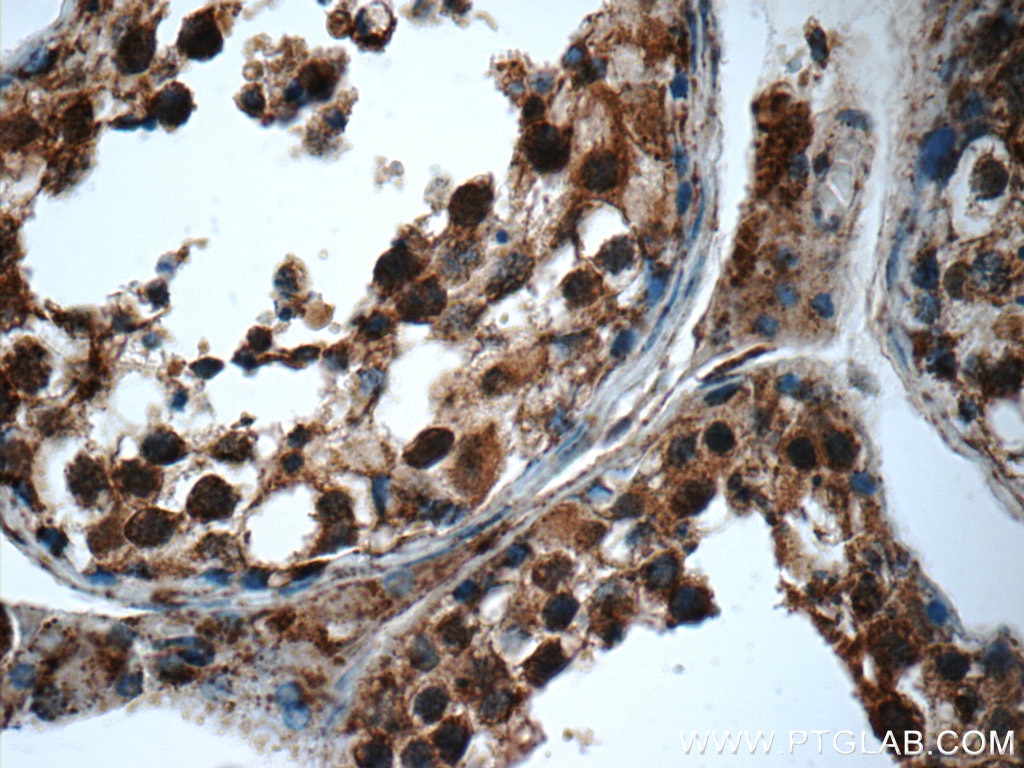 Immunohistochemistry (IHC) staining of human testis tissue using SMC4 Polyclonal antibody (24758-1-AP)