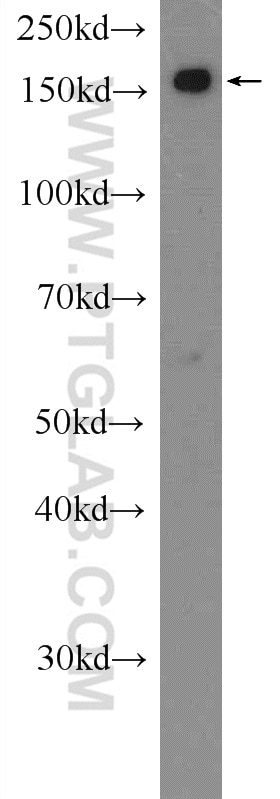 Western Blot (WB) analysis of MCF-7 cells using SMC4 Polyclonal antibody (24758-1-AP)