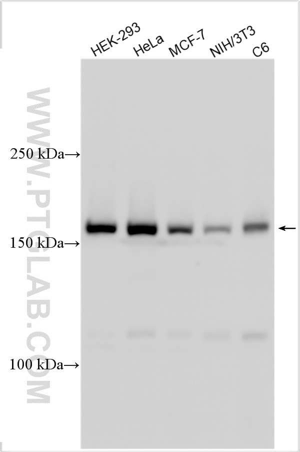 Western Blot (WB) analysis of various lysates using SMC4 Polyclonal antibody (24758-1-AP)