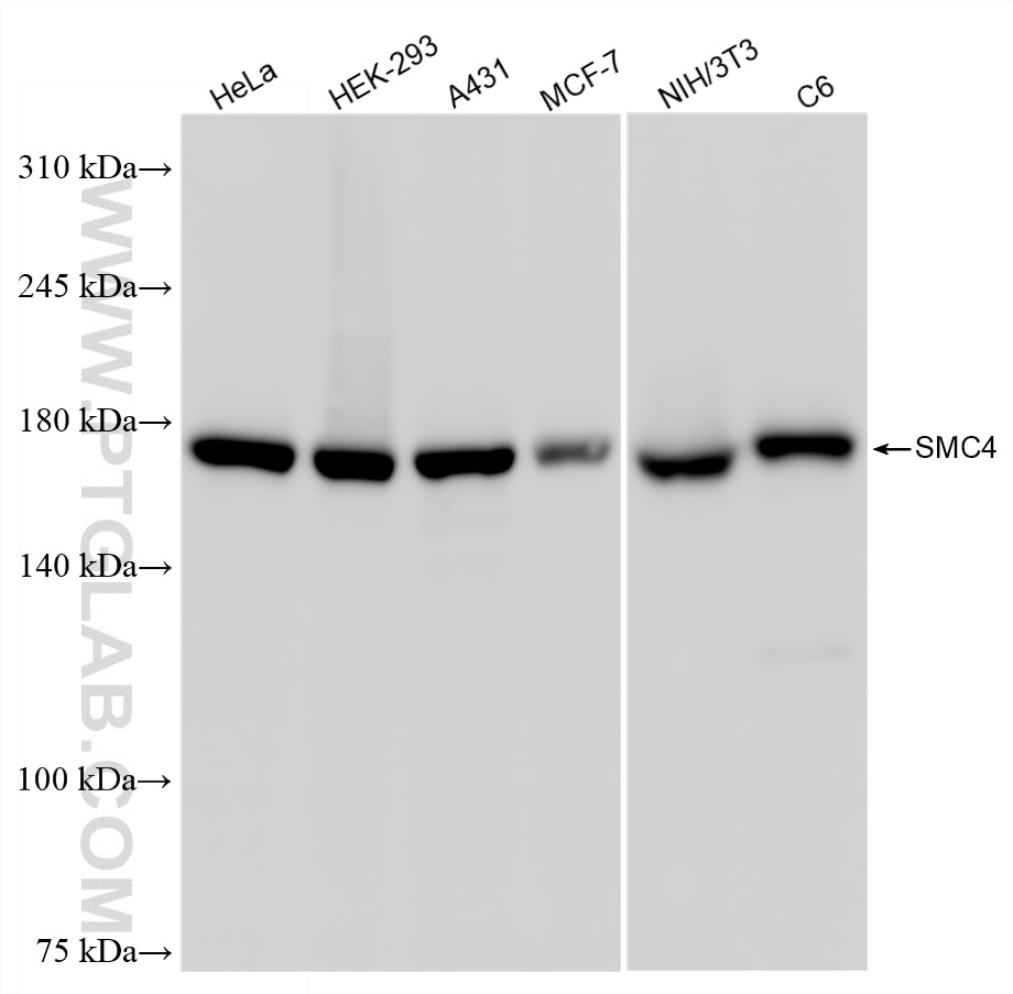 SMC4