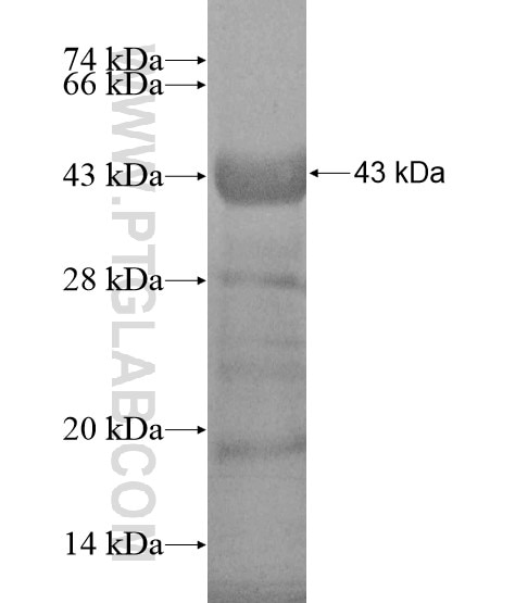 SMC4 fusion protein Ag19039 SDS-PAGE